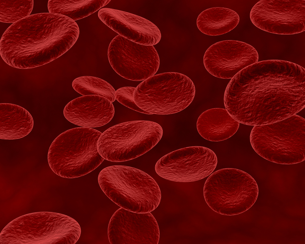 Mielodisplasia: doença silenciosa pode evoluir para leucemia