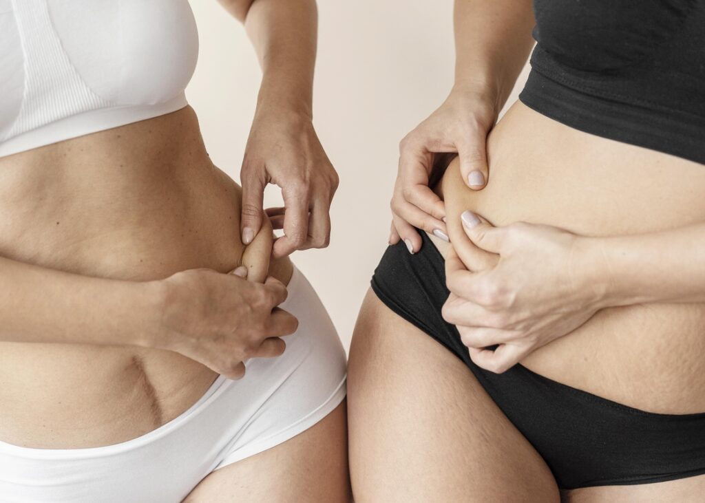 Lipoaspiração exige cuidados médicos rigorosos, alerta especialista