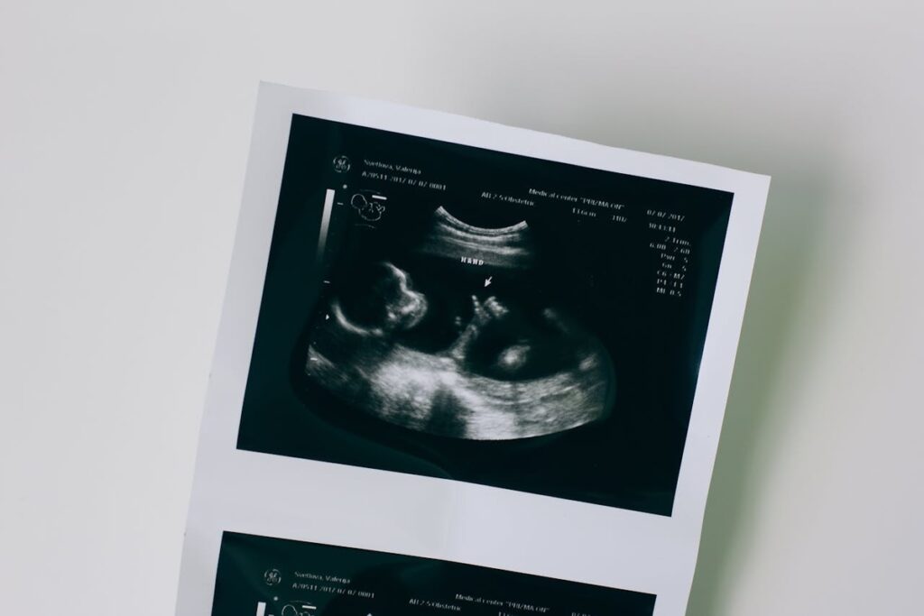 Cirurgia fetal minimamente invasiva tem resultado promissor